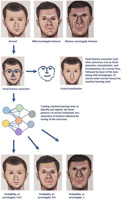 Artificial Intelligence and Machine Learning in Endocrinology and Metabolism: The Dawn of a New Era